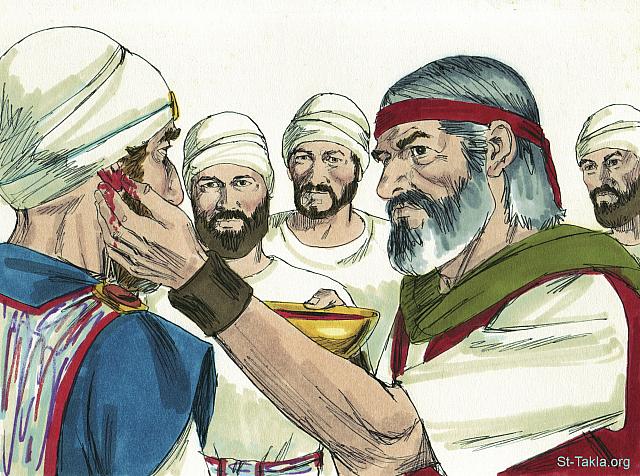 Illustration for Exodus 29:20